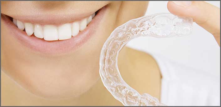 αόρατη - χωρίς σιδεράκια