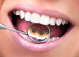 lingual orthodontics