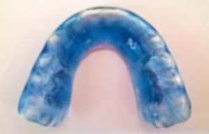 ναρθηκα για βρυγμου