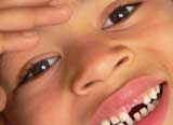 milk teeth