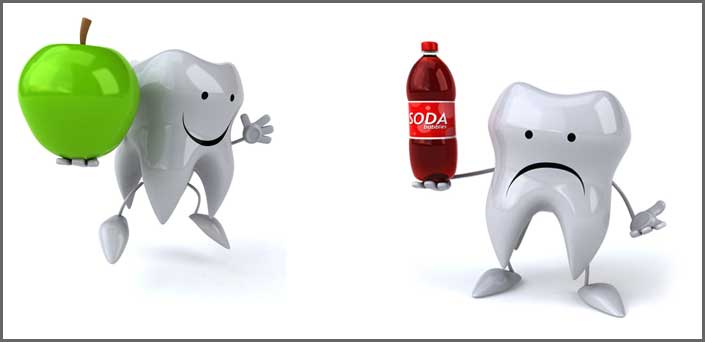 advice for tooth bonding