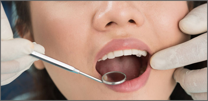 ΔΙΑΓΝΩΣΤΙΚΟΣ στοματολογικος  ΕΛΕΓΧΟΣ