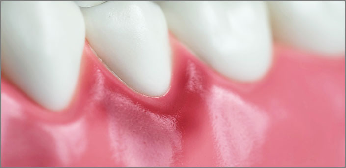 οδοντριατικη πρόληψη για εγκύους 