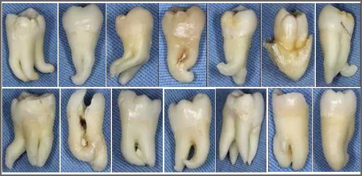 φρονιμητες