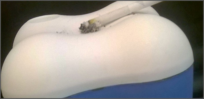 καπνισμα ζημια στα δοντια