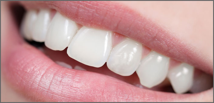 λεύκανση οδοντιατρος πειραια