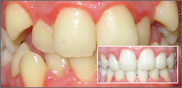 orthodontist piraeus