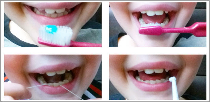 ΠΑΙΔΟΔΟΝΤΙΑ παιδοδοντιατροσ κεντρο πειραια