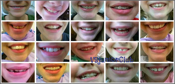 child dentist piraeus